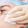 برداشتن خال و ضایعات پوستی