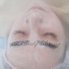 فیشیال تخصصی صورت