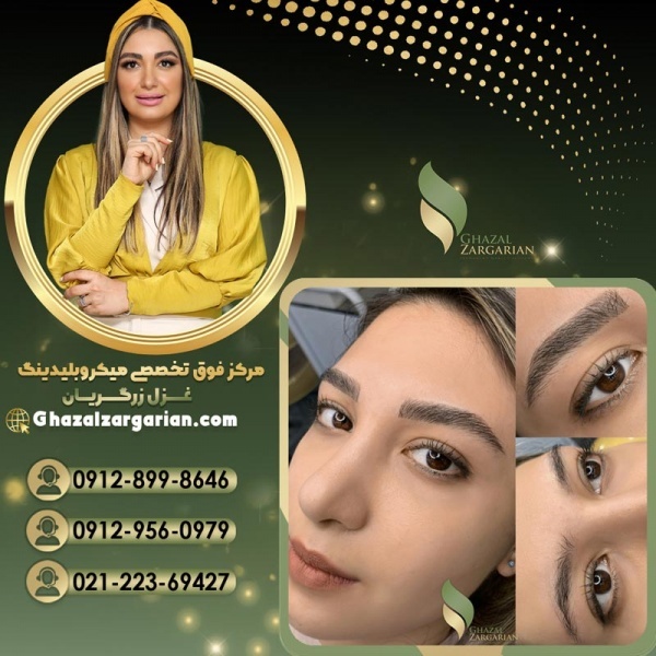 فیبروز ابرو دخترانه در مرکز غزل زرگریان