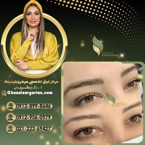 ریموو تاتو ابرو در مرکز غزل زرگریان