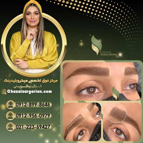 میکرو ابرو در مرکز میکروبلیدینگ غزل زرگریان